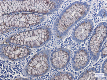 Anterior Gradient 2 Rabbit Monoclonal Antibody