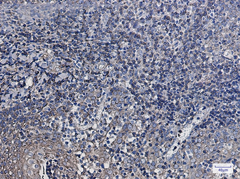 Synaptophysin Like Protein 1 Rabbit Monoclonal Antibody
