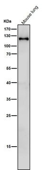 SPINK5 Rabbit mAb Antibody