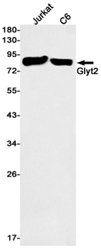 GlyT2 Rabbit mAb Antibody
