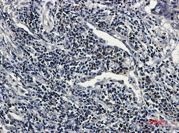 RING2 Rabbit Monoclonal Antibody