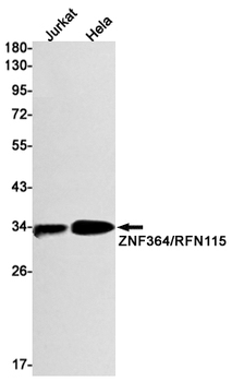 ZNF364 Rabbit mAb Antibody
