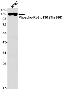 Rb2 p130 (Phospho-Thr986) Rabbit mAb Antibody
