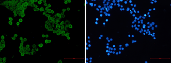 AMPK alpha 1 (Phospho-Ser496) Rabbit mAb Antibody