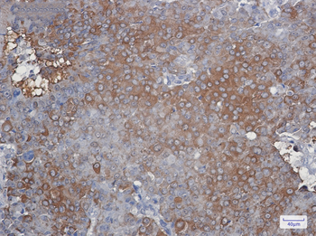 Peroxiredoxin 2 Rabbit mAb Antibody