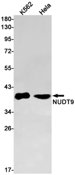 NUDT9 Rabbit mAb Antibody