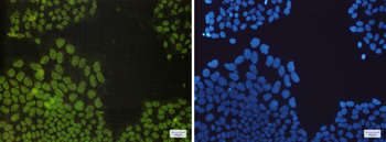 Nrf1 Rabbit Monoclonal Antibody