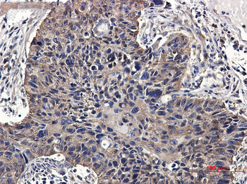 NME2 Rabbit Monoclonal Antibody