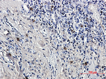 LTK Rabbit mAb Antibody