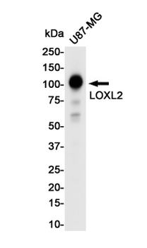 LOXL2 Rabbit mAb Antibody