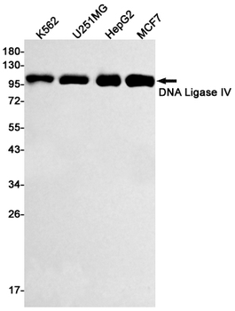 DNA Ligase IV Rabbit Monoclonal Antibody