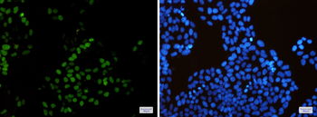KIFC1 Rabbit mAb Antibody