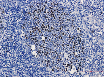 KIFC1 Rabbit mAb Antibody