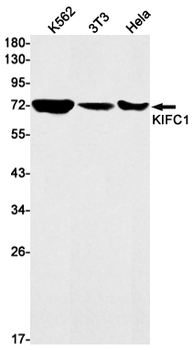 KIFC1 Rabbit mAb Antibody