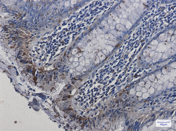 HspA2 Rabbit mAb Antibody