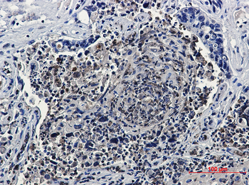 HJURP Rabbit mAb Antibody