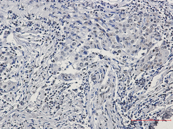 Histone H3 (Phospho-Ser10/Thr11) Rabbit mAb Antibody