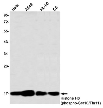 Histone H3 (Phospho-Ser10/Thr11) Rabbit mAb Antibody