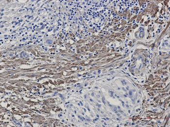 Filamin A/B (Phospho-Ser2152/Ser2107) Rabbit mAb Antibody