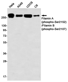 Filamin A/B (Phospho-Ser2152/Ser2107) Rabbit mAb Antibody