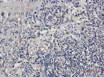 FDPS Rabbit Monoclonal Antibody