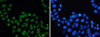 XPD Rabbit Monoclonal Antibody