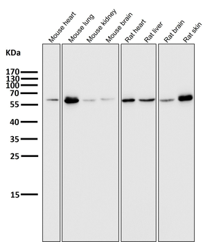 E2F1 Rabbit mAb Antibody