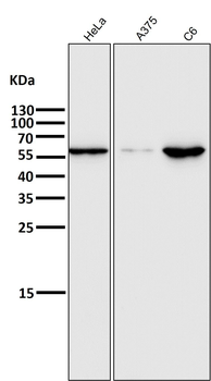 E2F1 Rabbit mAb Antibody