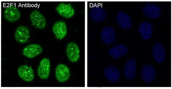 E2F1 Rabbit mAb Antibody
