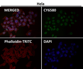 E2F1 Rabbit mAb Antibody
