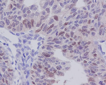 E2F1 Rabbit mAb Antibody