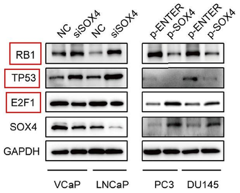 E2F1 Rabbit mAb Antibody