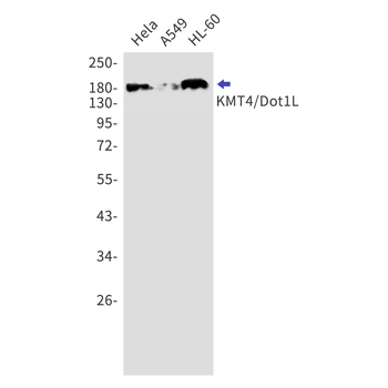 KMT4 Rabbit mAb Antibody