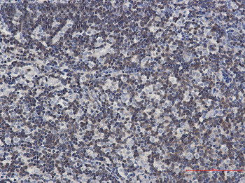 DGKA Rabbit mAb Antibody