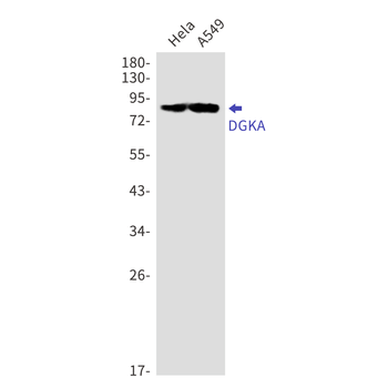 DGKA Rabbit mAb Antibody