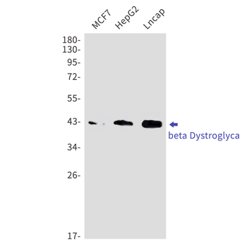 beta Dystroglycan Rabbit mAb Antibody