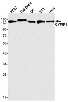 CYFIP1 Rabbit mAb Antibody