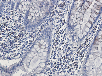 CLSTN1 Rabbit mAb Antibody