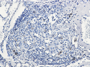 CDK1/2 (Phospho-Thr14) Rabbit mAb Antibody