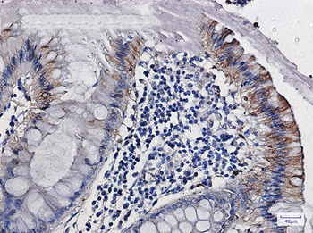 CDA Rabbit mAb Antibody