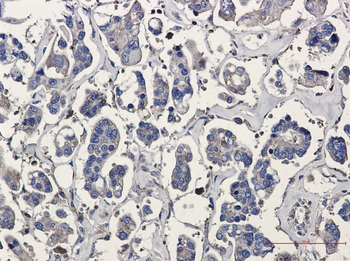p16 ARC Rabbit mAb Antibody
