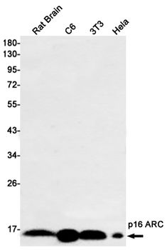 p16 ARC Rabbit mAb Antibody