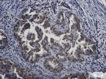 APPL Rabbit Monoclonal Antibody