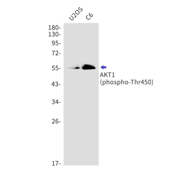 AKT1 (Phospho-Thr450) Rabbit mAb Antibody
