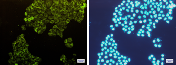 Fructose 6 Phosphate Kinase Rabbit mAb Antibody