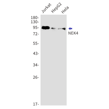 NEK4 Rabbit mAb Antibody