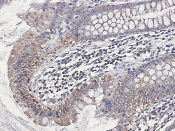 NDUFB1 Rabbit mAb Antibody
