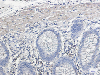 IL 11 Receptor alpha Rabbit mAb Antibody