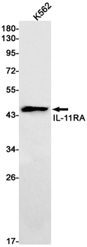 IL 11 Receptor alpha Rabbit mAb Antibody