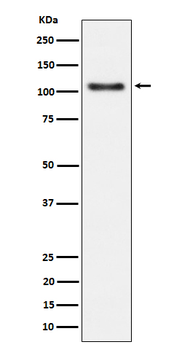 Rb (Phospho-Ser780) Rabbit mAb Antibody